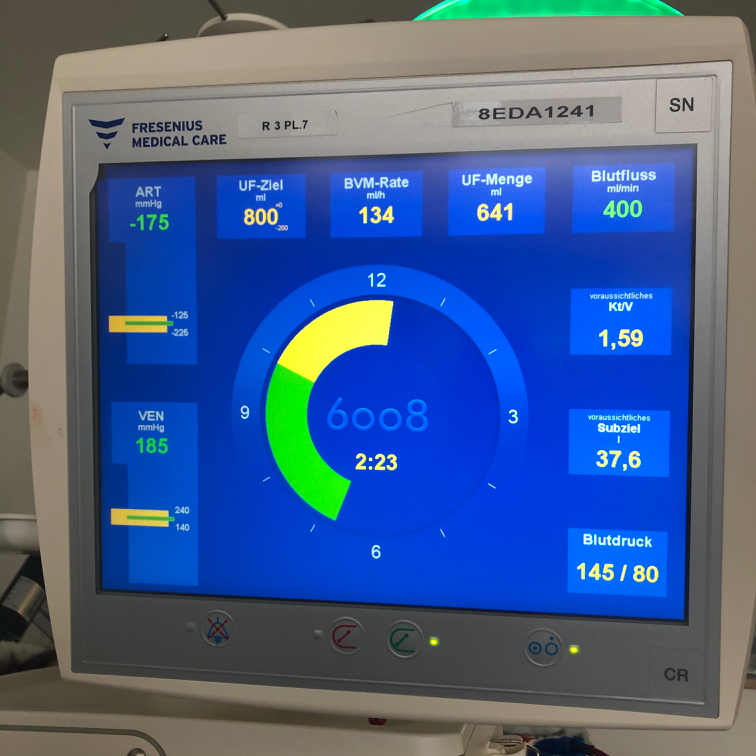 Dialyse-Monitor
